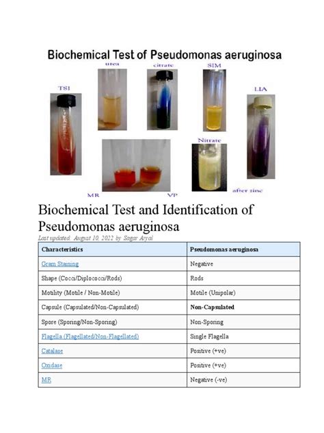 pseudomonas aeruginosa biochemical test results|7.1: Introduction to Biochemical Tests Part I .